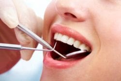 Why Regular Dental Cleanings Are Important?